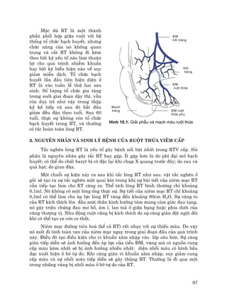 97
MÆc dï RT lµ mét thµnh
phÇn phèi hîp gi÷a ruét víi hÖ
thèng tæ chøc b¹ch huyÕt, nh−ng
chøc n¨ng cña nã kh«ng quan
träng vµ c¾t RT kh«ng ®i kÌm
theo bÊt kú yÕu tè nµo lµm thuËn
lîi cho qu¸ tr×nh nhiÔm khuÈn
hay bÊt kú biÓu hiÖn nµo vÒ suy
gi¶m miÔn dÞch. Tæ chøc b¹ch
huyÕt lÇn ®Çu tiªn hiÖn diÖn ë
RT lµ vµo tuÇn lÔ thø hai sau
sinh. Sè l−îng tæ chøc gia t¨ng
trong suèt giai ®o¹n dËy th×, vÉn
cßn duy tr× nh− vËy trong thËp
kû kÕ tiÕp vµ sau ®ã b¾t ®Çu
gi¶m ®Òu ®Æn theo tuæi. Sau 60
tuæi, thùc sù kh«ng cßn tæ chøc
b¹ch huyÕt trong RT, vµ th−êng
cã t¾c hoµn toµn lßng RT.
3. Nguyªn nh©n vµ sinh lý bÖnh cña ruét thõa viªm cÊp
T¾c nghÏn lßng RT lµ yÕu tè g©y bÖnh næi bËt nhÊt trong RTV cÊp. Sái
ph©n lµ nguyªn nh©n g©y t¾c RT hay gÆp. Ýt gÆp h¬n lµ do ph× ®¹i m« b¹ch
huyÕt; cã thÓ do chÊt baryt bÞ c« ®Æc l¹i khi chôp X quang tr−íc ®©y; do rau vµ
qu¶ h¹t; do giun ®òa.
Mét chuçi sù kiÖn x¶y ra sau khi t¾c lßng RT nh− sau: vËt t¾c nghÏn ë
gèc sÏ t¹o ra sù t¾c nghÏn mét quai kÝn trong khi sù bµi tiÕt cña niªm m¹c RT
vÉn tiÕp tôc lµm cho RT c¨ng ra. ThÓ tÝch lßng RT b×nh th−êng chØ kho¶ng
0,1ml. Nã kh«ng cã mét lßng èng thùc sù. Sù tiÕt cña niªm m¹c RT chØ kho¶ng
0,5ml cã thÓ lµm cho ¸p lùc lßng RT t¨ng ®Õn kho¶ng 60cm H2O. Sù c¨ng to
cña RT kÝch thÝch lªn ®Çu mót thÇn kinh h−íng t©m mang c¶m gi¸c ®au t¹ng,
nã g©y triÖu chøng ®au m¬ hå, ©m Ø, lan to¶ ë gi÷a bông hoÆc phÝa d−íi cña
vïng th−îng vÞ. Nhu ®éng ruét còng bÞ kÝch thÝch do sù c¨ng gi·n ®ét ngét ®«i
khi cã thÓ t¹o ra c¬n co th¾t.
Niªm m¹c ®−êng tiªu ho¸ (kÓ c¶ RT) rÊt nh¹y víi sù thiÕu m¸u. Do vËy
nã mÊt ®i tÝnh toµn vÑn cña niªm m¹c ngay trong giai ®o¹n ®Çu cña qu¸ tr×nh
nµy. §iÒu ®ã t¹o ®iÒu kiÖn cho vi khuÈn x©m nhËp vµo líp s©u h¬n. Sù c¨ng
gi·n tiÕp diÔn sÏ ¶nh h−ëng ®Õn ¸p lùc cña tiÓu §M, vïng mµ cã nguån cung
cÊp m¸u kÐm nhÊt sÏ bÞ ¶nh h−ëng nhiÒu nhÊt: diÖn nhåi m¸u cã h×nh bÇu
dôc xuÊt hiÖn ë bê tù do. Khi c¨ng gi·n vi khuÈn x©m nhËp, suy gi¶m cung
cÊp m¸u vµ sù nhåi m¸u tiÕp diÔn sÏ g©y thñng RT. Th−êng lµ ®i qua mét
trong nh÷ng vïng bÞ nhåi m¸u ë bê tù do cña RT.
Manh
trµng
Håi
trµng
§M
håi trµng
§M
ruét thõa
§M ruét
thõa phô
H×nh 10.1. Gi¶i phÉu vµ m¹ch m¸u ruét thõa
 