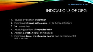 Opg Infection Orthopantomogram OPG and Dental Panoromic Radiography | PPTX