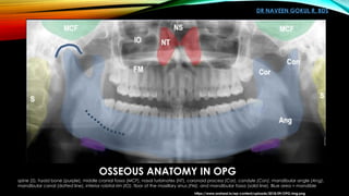 Lablled Opg Orthopantomogram OPG and Dental Panoromic Radiography | PPTX