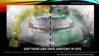 Orthopantomogram OPG and Dental Panoromic Radiography | PPTX