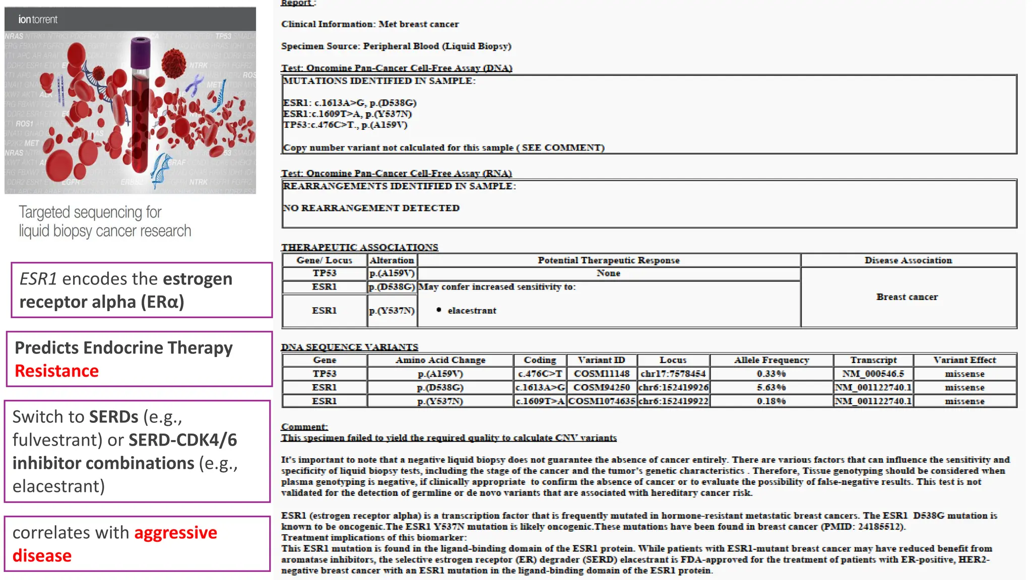 ESR1 encodes the estrogen
receptor alpha (ERα)
Predicts Endocrine Therapy
Resistance
Switch to SERDs (e.g.,
fulvestrant) or SERD-CDK4/6
inhibitor combinations (e.g.,
elacestrant)
correlates with aggressive
disease