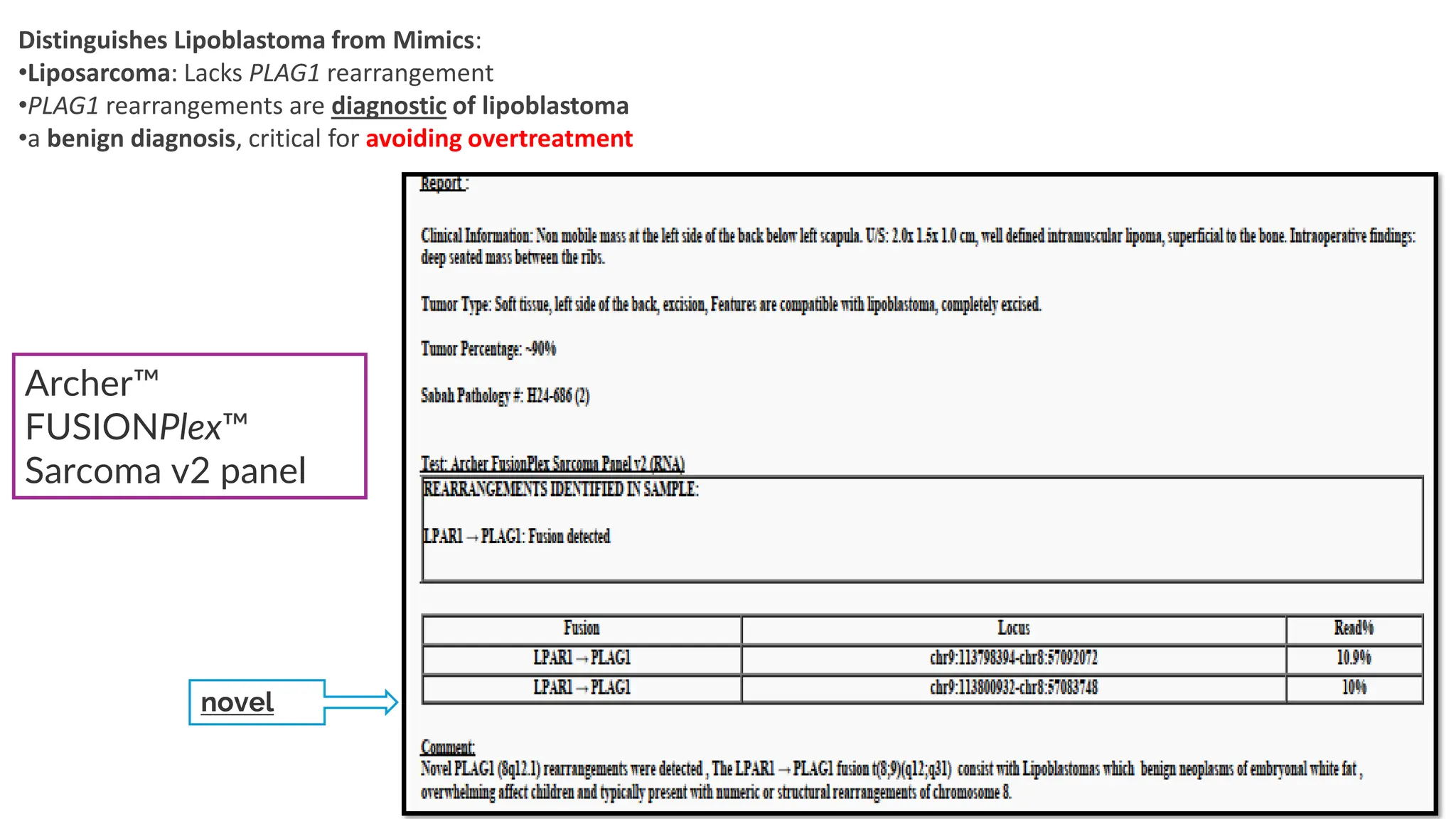 novel
Archer
FUSIONPlex
Sarcoma v2 panel
Distinguishes Lipoblastoma from Mimics:
•Liposarcoma: Lacks PLAG1 rearrangement
•PLAG1 rearrangements are diagnostic of lipoblastoma
•a benign diagnosis, critical for avoiding overtreatment