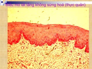 Biểu mô lát tầng không sừng hoá (thực quản)
 