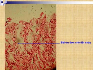 BM trụ đơn chế tiết nhày
 