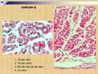 TuyÕn ®¸y vÞ
1
2
1
3
1. TÕ bµo viÒn;
2. TÕ bµo chÝnh;
3. M« liªn kÕt cña líp ®Öm;
4. C¬ niªm.
4
 
