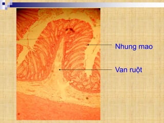 Van ruột
Nhung mao
 