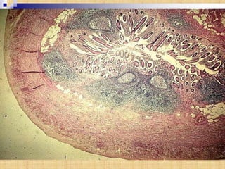 ỐNG TIÊU HÓA 2013