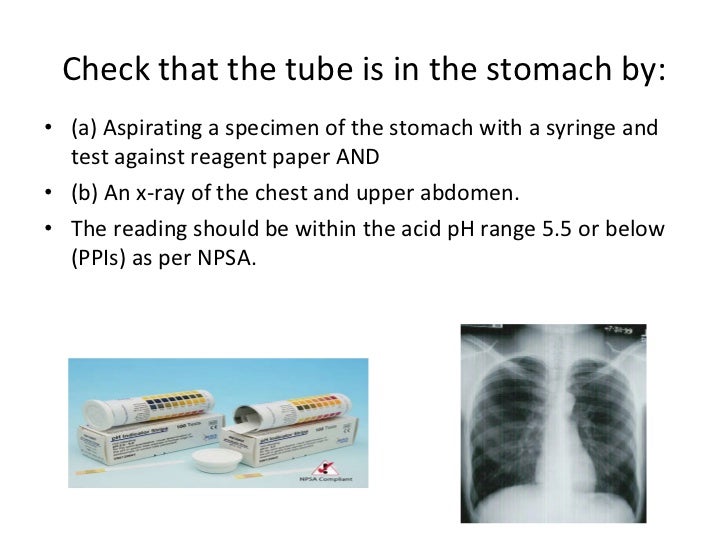 Ng tubes policy and guidelines ICU Adult