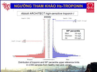 24
NGƯỠNG THAM KHẢO Hs-TROPONIN
 