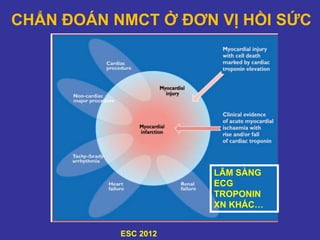 ESC 2012
CHẨN ĐOÁN NMCT Ở ĐƠN VỊ HỒI SỨC
LÂM SÀNG
ECG
TROPONIN
XN KHÁC…
 