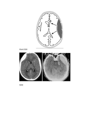 Nguyên lư ho t --ng c-a máy ctscan | PDF