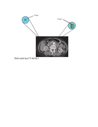 Nguyên lư ho t --ng c-a máy ctscan | PDF