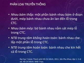 PHÂN LOẠI TRUYỀN THỐNG
• Nhau bám thấp: một phần bánh nhau bám ở đoạn
dưới, mép bánh nhau chưa ăn lan đến lỗ trong
CTC.
• Nhau bám mép: bờ bánh nhau nằm sát mép lỗ
trong CTC.
• NTĐ trung tâm không hoàn toàn: bánh nhau che
lấp một phần lỗ trong CTC.
• NTĐ trung tâm hoàn toàn: bánh nhau che kín hết
cả lỗ trong CTC.
Đại học Y dược Thành phố Hồ Chí Minh, 2011. Sản Phụ Khoa, tập 1. 3 rd
ed. Hồ Chí Minh: NXB Y học.
 