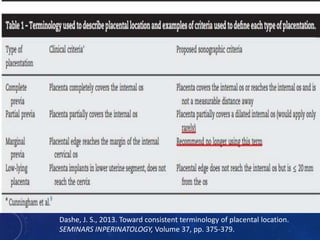 Dashe, J. S., 2013. Toward consistent terminology of placental location.
SEMINARS INPERINATOLOGY, Volume 37, pp. 375-379.
 