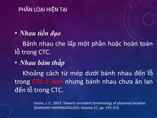 PHÂN LOẠI HIỆN TẠI
• Nhau tiền đạo
Bánh nhau che lấp một phần hoặc hoàn toàn
lỗ trong CTC.
• Nhau bám thấp
Khoảng cách từ mép dưới bánh nhau đến lỗ
trong CTC ≤ 2cm nhưng bánh nhau chưa ăn lan
đến lỗ trong CTC.
Dashe, J. S., 2013. Toward consistent terminology of placental location.
SEMINARS INPERINATOLOGY, Volume 37, pp. 375-379.
 