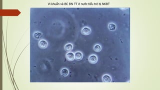 Vi khuẩn và BC ĐN TT ở nước tiểu trẻ bị NKĐT
 