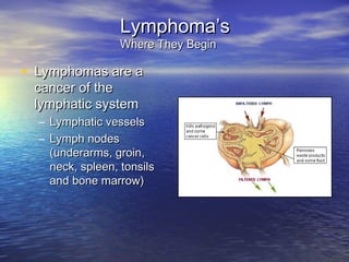 Lymphoma’sLymphoma’s
Where They BeginWhere They Begin
• Lymphomas are aLymphomas are a
cancer of thecancer of the
lymphatic systemlymphatic system
– Lymphatic vesselsLymphatic vessels
– Lymph nodesLymph nodes
(underarms, groin,(underarms, groin,
neck, spleen, tonsilsneck, spleen, tonsils
and bone marrow)and bone marrow)
 
