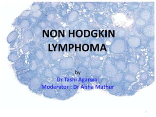 NON HODGKIN
LYMPHOMA
by
Dr Tashi Agarwal
Moderator : Dr Abha Mathur
1
 