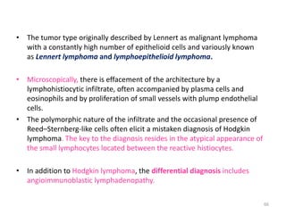 • The tumor type originally described by Lennert as malignant lymphoma
with a constantly high number of epithelioid cells ...