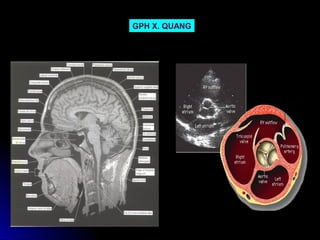 GPH X. QUANG
 