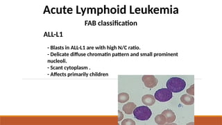 Acute Lymphoid Leukemia
- Blasts in ALL-L1 are with high N/C ratio.
- Delicate diffuse chromatin pattern and small prominent
nucleoli.
- Scant cytoplasm .
- Affects primarily children
FAB classification
ALL-L1
 