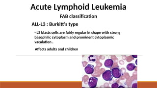 Acute Lymphoid Leukemia
FAB classification
ALL-L3 : Burkitt's type
- L3 blasts cells are fairly regular in shape with strong
basophilic cytoplasm and prominent cytoplasmic
vaculation .
Affects adults and children
 