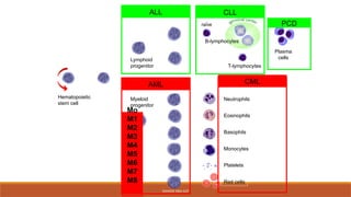 Hematopoietic
stem cell
Neutrophils
Eosinophils
Basophils
Monocytes
Platelets
Red cells
Myeloid
progenitor
Lymphoid
progenitor
B-lymphocytes
T-lymphocytes
Plasma
cells
naïve
ALL
AML
TANVEER TARA SUIT
CLL
PCD
CML
Mo
M1
M2
M3
M4
M5
M6
M7
M8
 