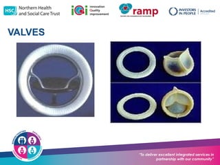 Nhsct NHSCT-Angina-Powerpoint (2).potx CARDIAC SURGERY | POTX