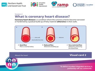 Nhsct NHSCT-Angina-Powerpoint (2).potx CARDIAC SURGERY | POTX