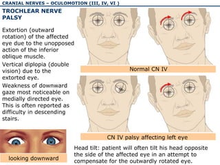 Out Word Rotation The physiology and pathology of cranial nerves I-VI | PPT