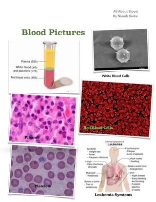 All About Blood
By Niamh Burke

Blood Pictures

White Blood Cells

Red Blood Cells

Plasma

Platelets
Leukemia Symtoms

 