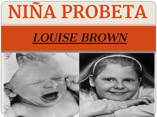 LOUISE BROWN
NIÑA PROBETA
 