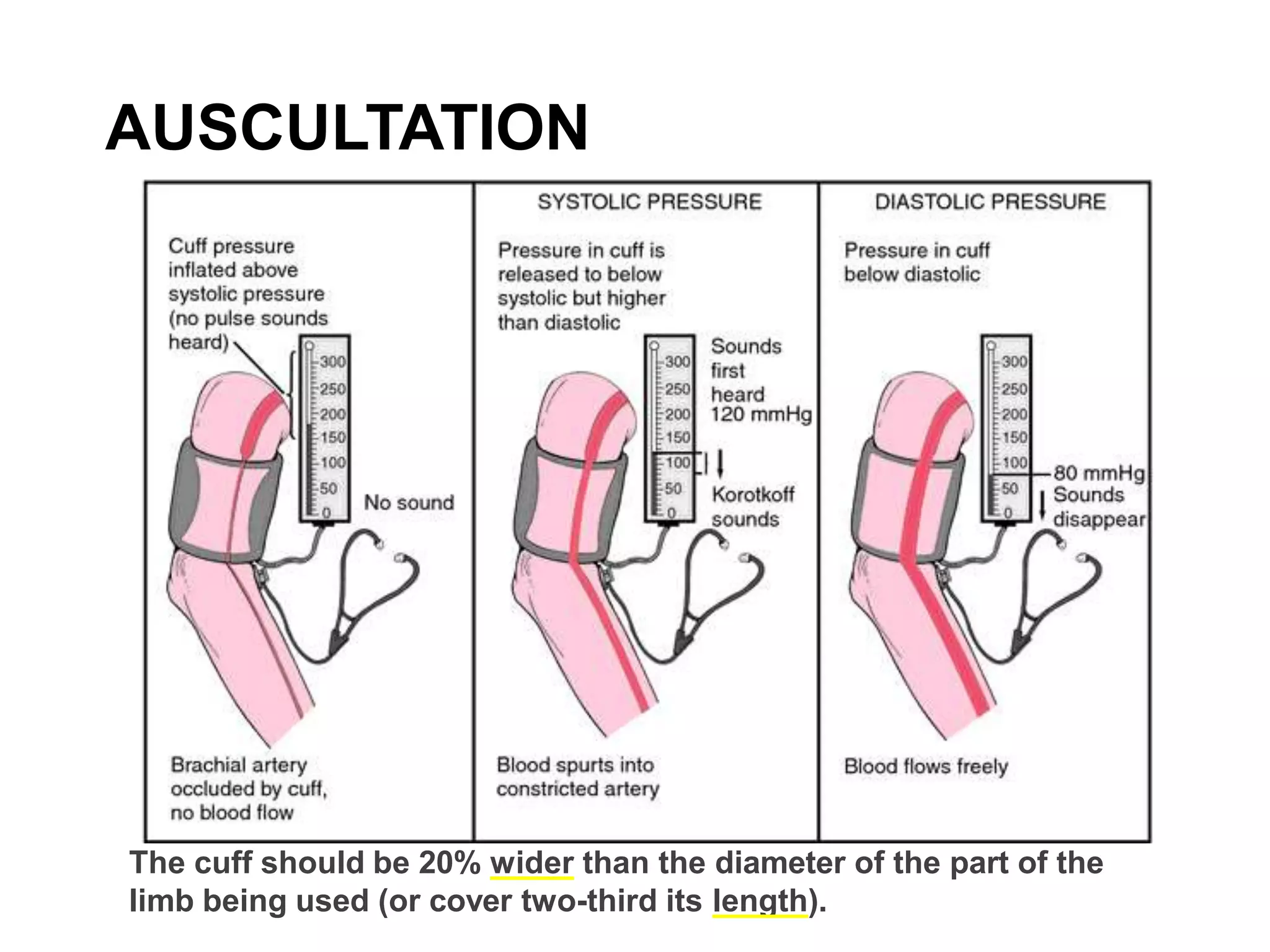 AUSCULTATION
The cuff should be 20% wider than the diameter of the part of the
limb being used (or cover two-third its length).
 