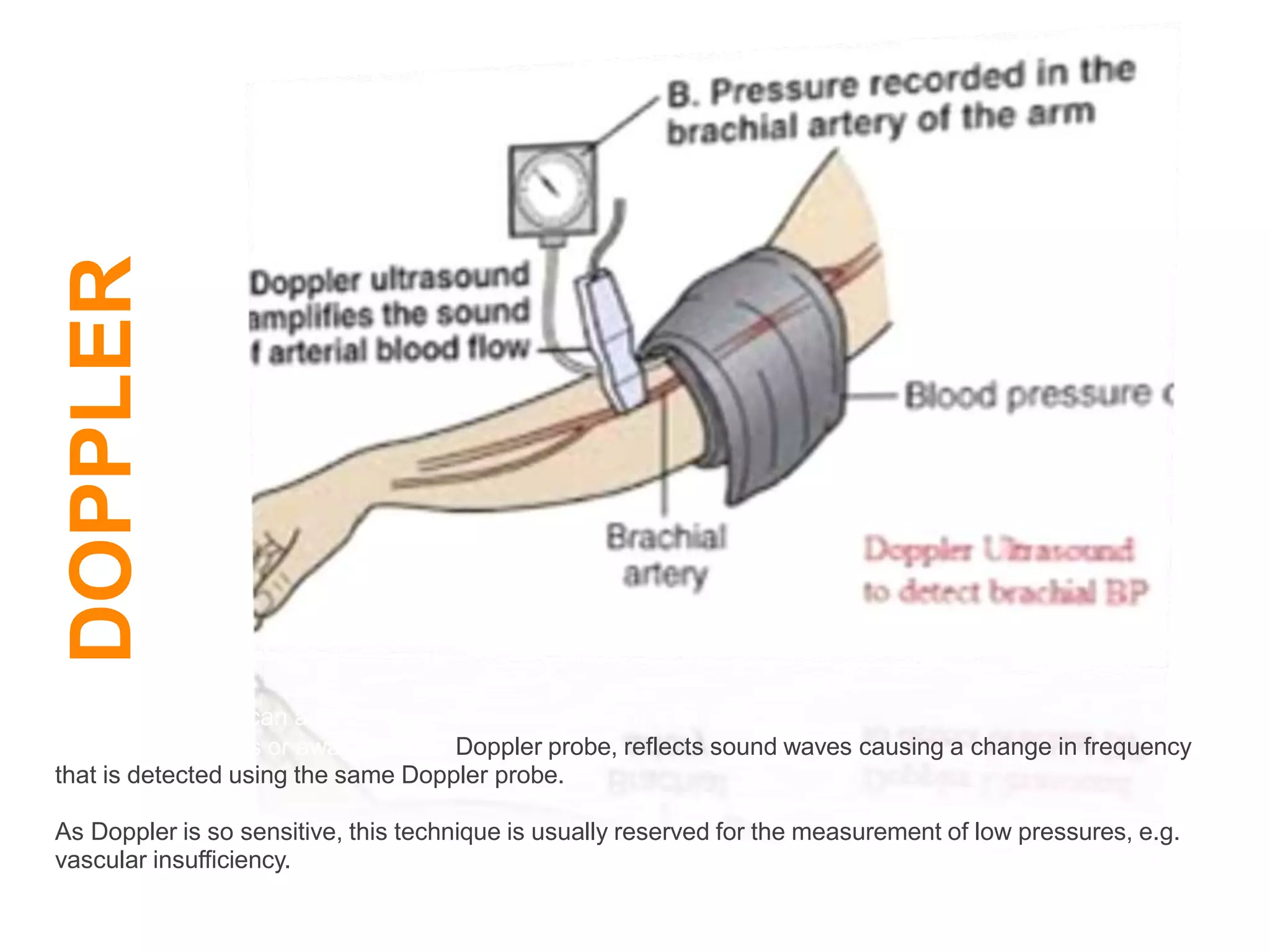 DOPPLER
Systolic pressure can also be determined using the Doppler principle.
Blood flow towards or away from the Doppler probe, reflects sound waves causing a change in frequency
that is detected using the same Doppler probe.
As Doppler is so sensitive, this technique is usually reserved for the measurement of low pressures, e.g.
vascular insufficiency.
 