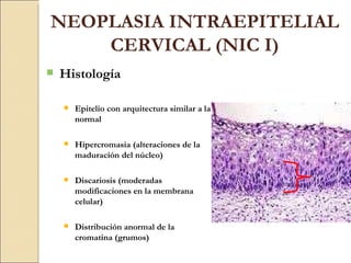 NEOPLASIA INTRAEPITELIAL CERVICAL (NIC I) Histología Epitelio con arquitectura similar a la normal Hipercromasia (alteraciones de la maduración del núcleo) Discariosis (moderadas modificaciones en la membrana celular) Distribución anormal de la cromatina (grumos) 