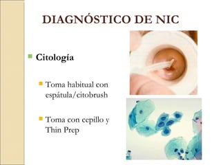 DIAGNÓSTICO DE NIC Citología Toma habitual con espátula/citobrush Toma con cepillo y Thin Prep 