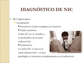 Dx Colposcópico  Localización Exocérvix: Lesión completa en exocérvix Endo-exocérvix: Unión EC no se visualiza y se profundiza en el canal endocervical Endocérvix: La unión EC es alta en el canal endocervical  y el área patológica se encuentra completamente en el endocérvix DIAGNÓSTICO DE NIC 