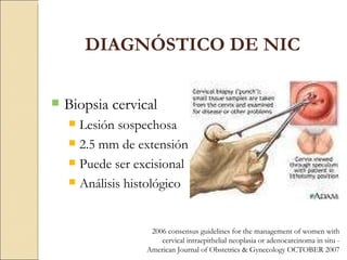 Biopsia cervical Lesión sospechosa 2.5 mm de extensión Puede ser excisional Análisis histológico DIAGNÓSTICO DE NIC 2006 consensus guidelines for the management of women with cervical intraepithelial neoplasia or adenocarcinoma in situ -  American Journal of Obstetrics & Gynecology OCTOBER 2007 