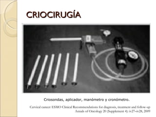 CRIOCIRUGÍA Criosondas, aplicador, manómetro y cronómetro.   Cervical cancer: ESMO Clinical Recommendations for diagnosis, treatment and follow-up Annals of Oncology 20 (Supplement 4): iv27–iv28, 2009 