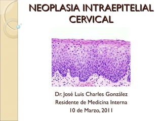 NEOPLASIA INTRAEPITELIAL CERVICAL Dr. José Luis Charles González Residente de Medicina Interna 10 de Marzo, 2011 