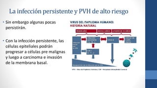 La infección persistente y PVH de alto riesgo
• Sin embargo algunas pocas
persistirán.
• Con la infección persistente, las
células epiteliales podrán
progresar a células pre malignas
y luego a carcinoma e invasión
de la membrana basal.
 