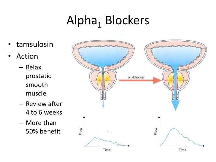 Nice guidance for luts management for g ps presentation 2012 0208