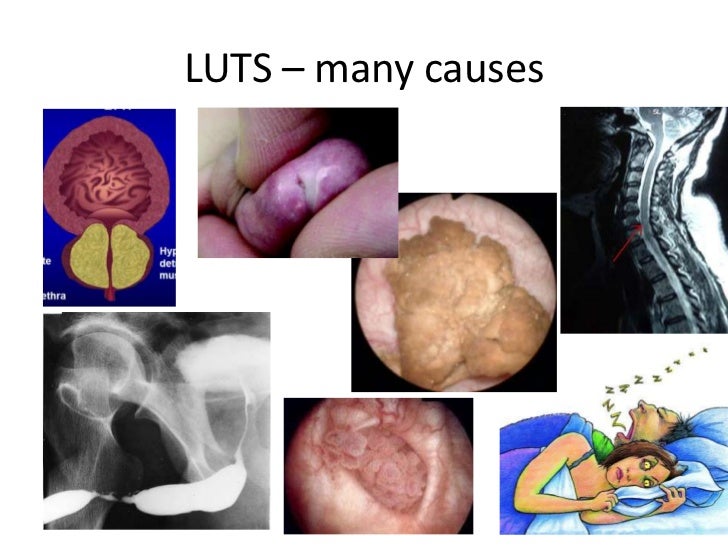 Nice guidance for luts management for g ps presentation 2012 0208