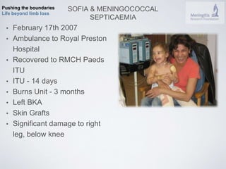Pushing the boundaries 
Life beyond limb loss 
SOFIA & MENINGOCOCCAL 
SEPTICAEMIA 
• February 17th 2007 
• Ambulance to Royal Preston 
Hospital 
• Recovered to RMCH Paeds 
ITU 
• ITU - 14 days 
• Burns Unit - 3 months 
• Left BKA 
• Skin Grafts 
• Significant damage to right 
leg, below knee 
 