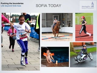 Pushing the boundaries 
Life beyond limb loss SOFIA TODAY 
 