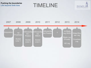 Pushing the boundaries 
Life beyond limb loss TIMELINE 
2007 2008 2009 2010 2011 2012 2013 2014 
Amputation 
Orthosis/Sp 
lint Preston 
x 
1st Blade 
Leg (NHS) 
Blade Leg 
(Private) 
HD Leg 
Orthosis/Sp 
lint - 
Preston 
Socket 
Liner 2 
Orthosis/Sp 
lint 
RMCH 
Socket 
Liner 3 
1st 
Prosthesis 
Socket 
Liner 1 
Water/Sho 
wer Leg 
Coverless 
Leg 
 