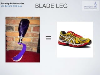 Pushing the boundaries 
Life beyond limb loss BLADE LEG 
= 
 
