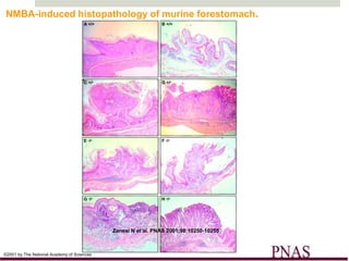 NMBA-induced histopathology of murine forestomach.




                                            Zanesi N et al. PNAS 2001;98:10250-10255



©2001 by The National Academy of Sciences
 
