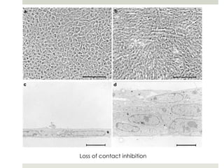 Loss of contact inhibition
 