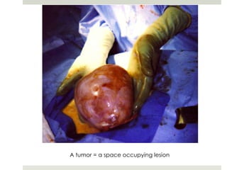 A tumor = a space occupying lesion
 